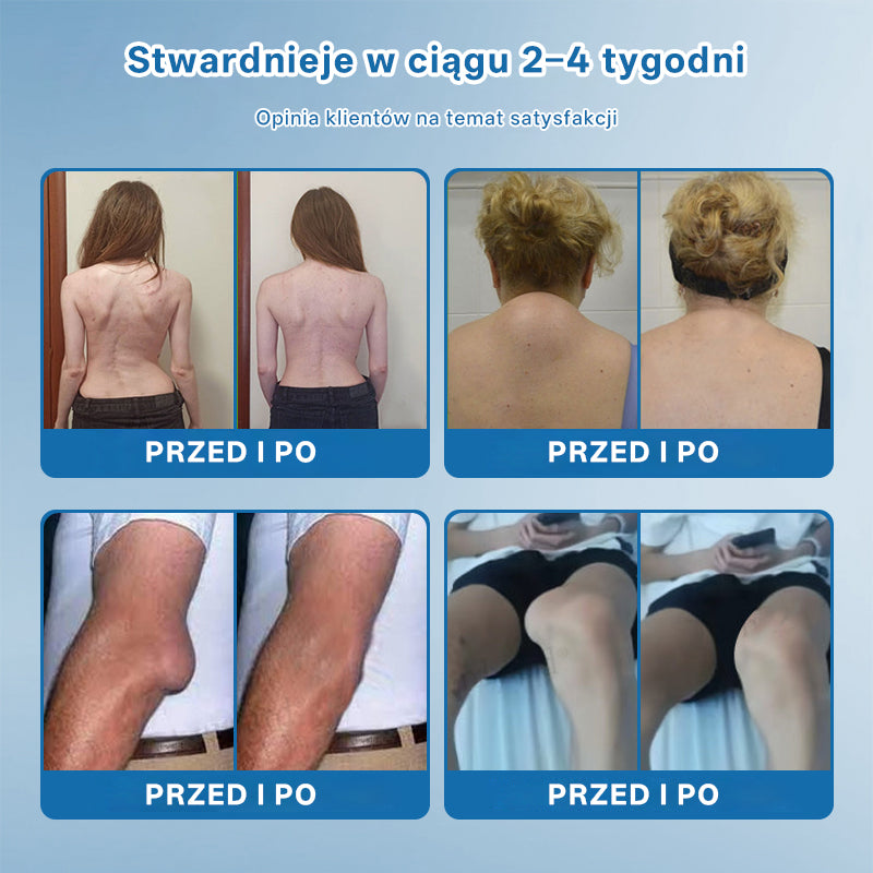 🥇CleraNaure® BPC-157 Krem do Leczenia Stawów🦴 Leczy Artretyzm, Neuropatię, Reumatyzm, Urazy Sportowe i Więcej