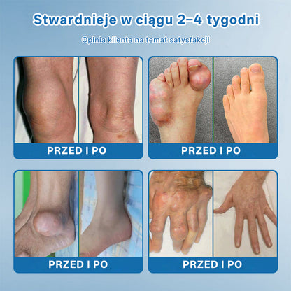 🥇CleraNaure® BPC-157 Krem do Leczenia Stawów🦴 Leczy Artretyzm, Neuropatię, Reumatyzm, Urazy Sportowe i Więcej