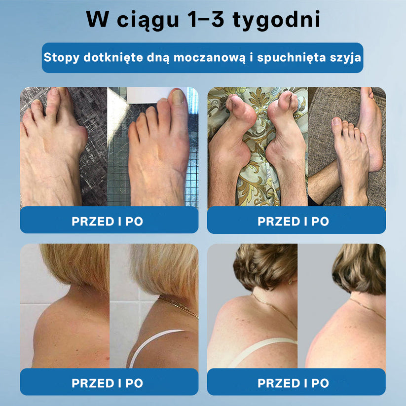 🥇CleraNaure® BPC-157 Krem do Leczenia Stawów🦴 Leczy Artretyzm, Neuropatię, Reumatyzm, Urazy Sportowe i Więcej