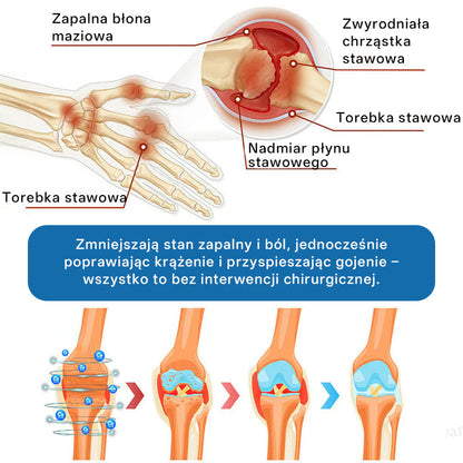 🥇CleraNaure® BPC-157 Krem do Leczenia Stawów🦴 Leczy Artretyzm, Neuropatię, Reumatyzm, Urazy Sportowe i Więcej