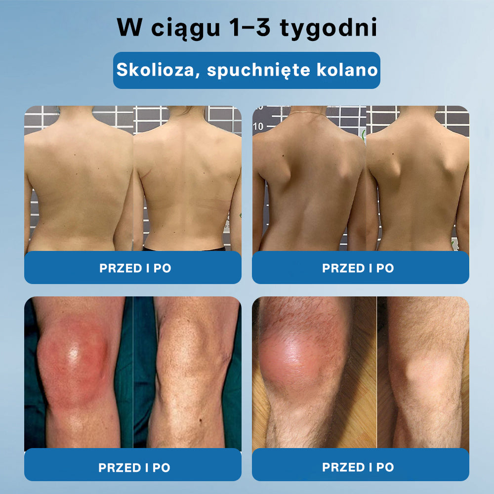 🥇CleraNaure® BPC-157 Krem do Leczenia Stawów🦴 Leczy Artretyzm, Neuropatię, Reumatyzm, Urazy Sportowe i Więcej
