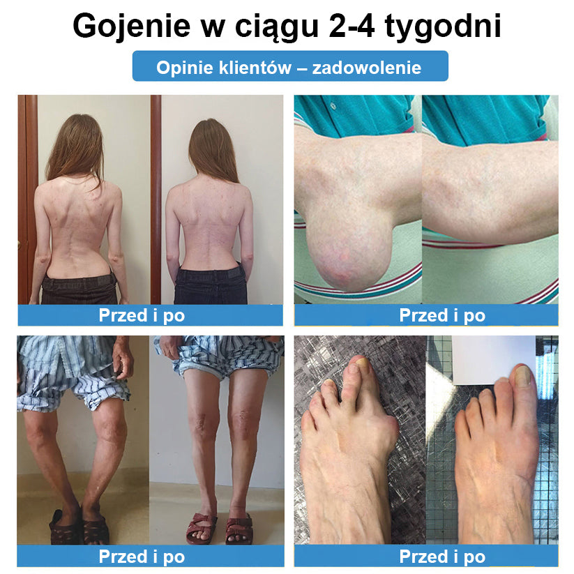 🏅CleraNaure® nanojehličková náplast na klouby