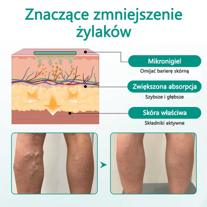🥇CleraNaure® LegRenew Plaster na żylaki