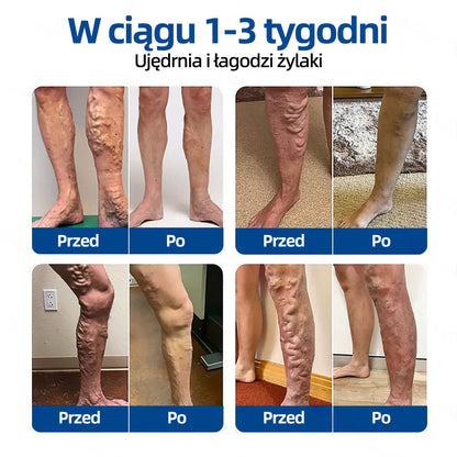 💎Healrize® VeinTarget Plaster z mikroigłami✨