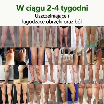 🌿Pożegnaj się z opuchniętymi, bolącymi nogami – CleraNaure® FluidEase Profesjonalny krem na krążenie w nogach przynosi prawdziwą ulgę! ✨🦵