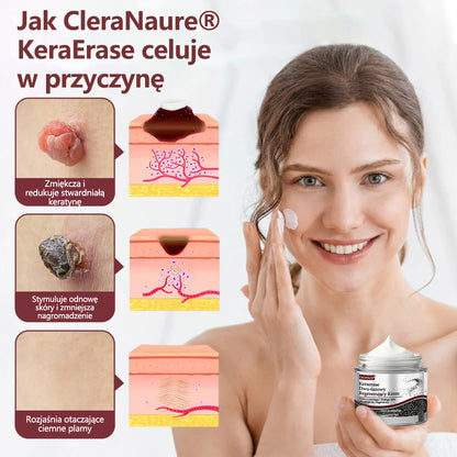 💎 CleraNaure® Keraerase Krem Odnowy o Podwójnym Działaniu - Krem z podwójnym działaniem do regeneracji skóry💎