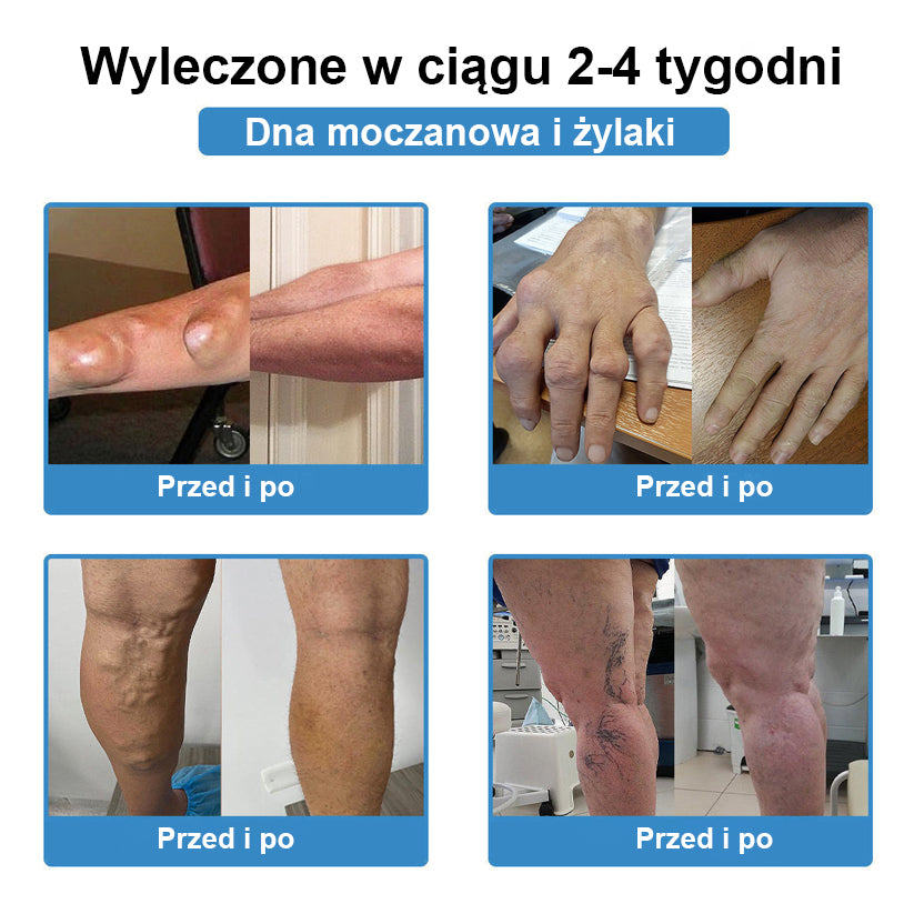 🏅CleraNaure® nanojehličková náplast na klouby