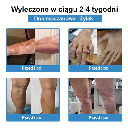 🏅CleraNaure® nanojehličková náplast na klouby