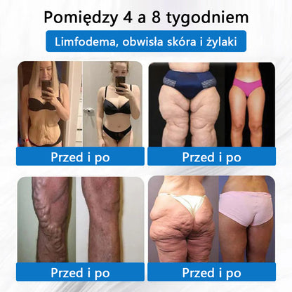 ⭐⭐⭐CleraNaure® 7-w-1 metabolizm i ujędrniająca plastra (technologia mikrodyfuzji, 24-godzinny efekt) do kontroli wagi, apetytu, energii i metabolizmu cukru 💡
