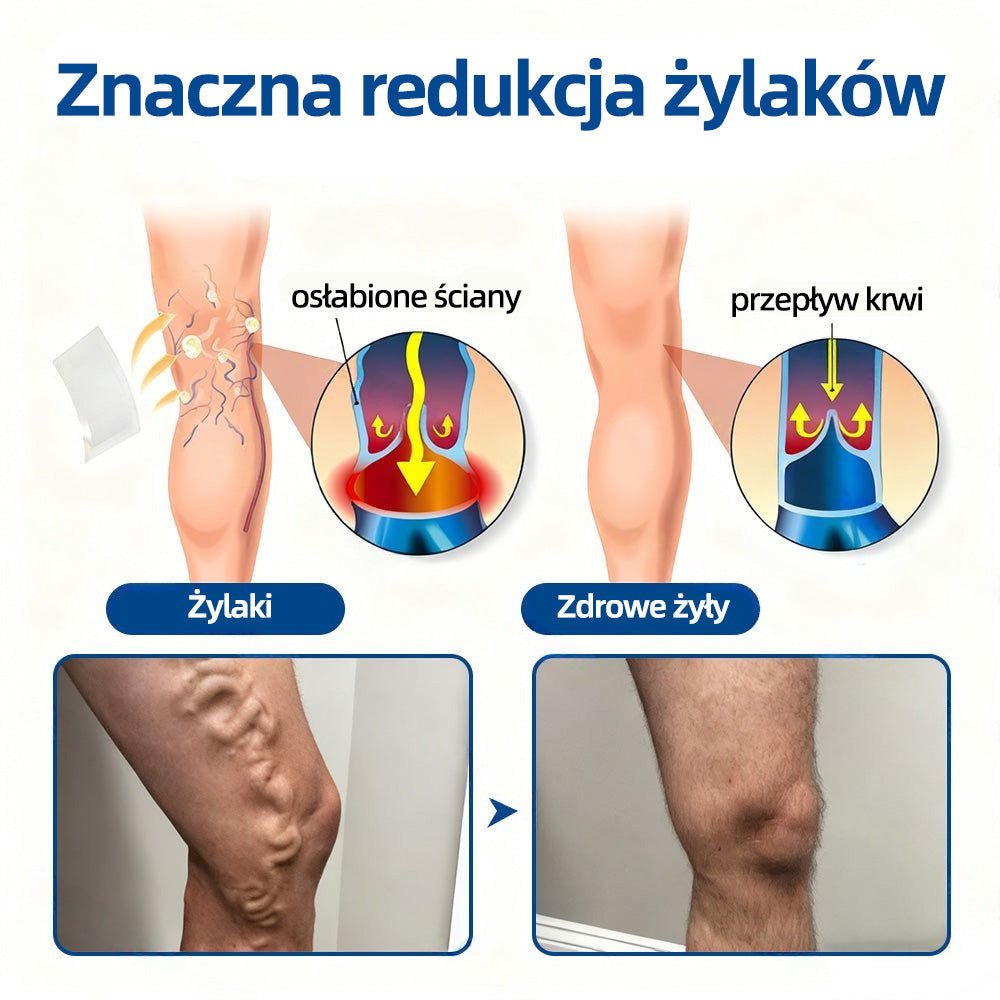 💎Healrize® VeinTarget Plaster z mikroigłami✨