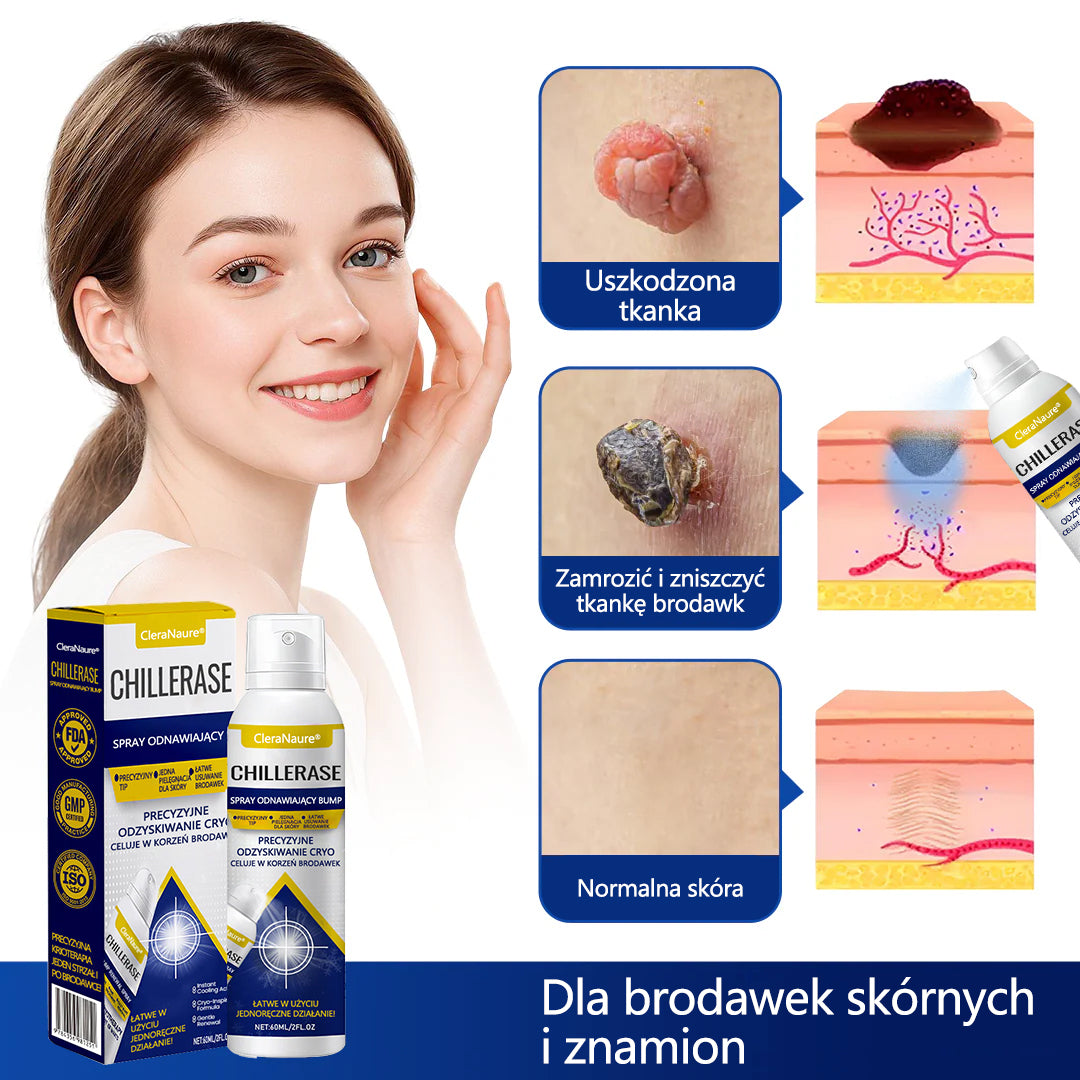 🥇CleraNaure® ChillErase spray do usuwania nierówności