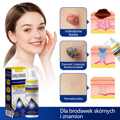 🥇CleraNaure® ChillErase spray do usuwania nierówności