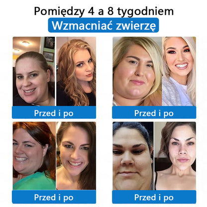 ⭐⭐⭐CleraNaure® 7-w-1 metabolizm i ujędrniająca plastra (technologia mikrodyfuzji, 24-godzinny efekt) do kontroli wagi, apetytu, energii i metabolizmu cukru 💡