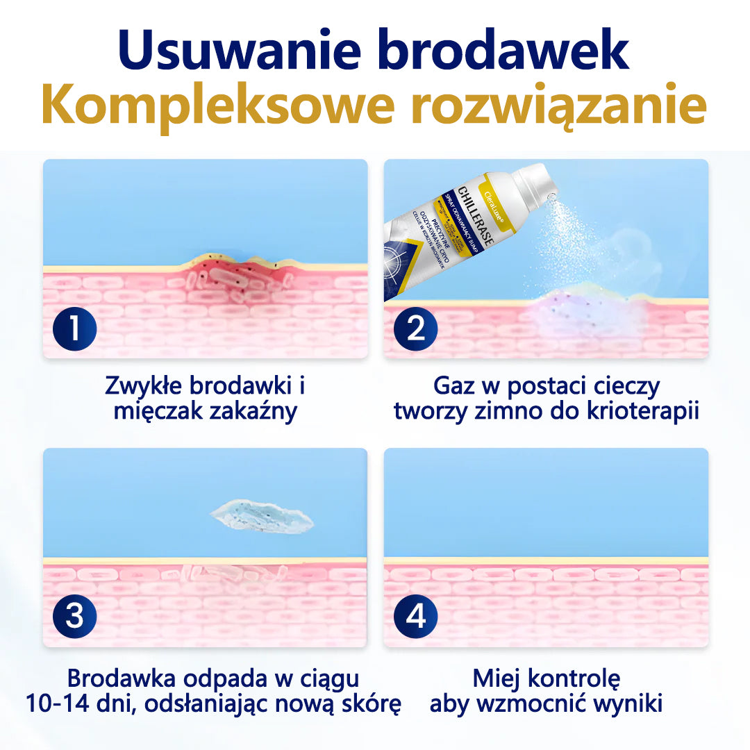 🥇CleraNaure® ChillErase spray do usuwania nierówności
