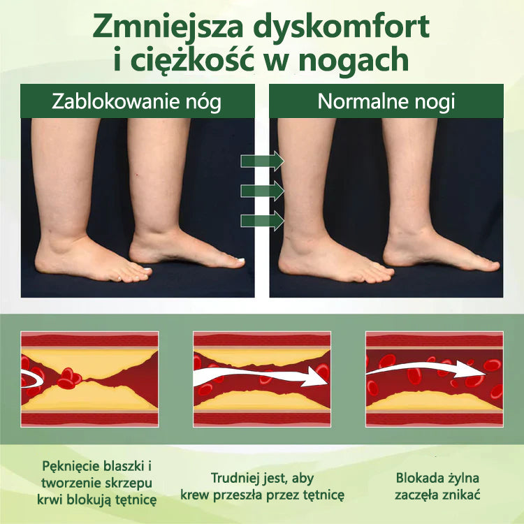 🌿Pożegnaj się z opuchniętymi, bolącymi nogami – CleraNaure® FluidEase Profesjonalny krem na krążenie w nogach przynosi prawdziwą ulgę! ✨🦵