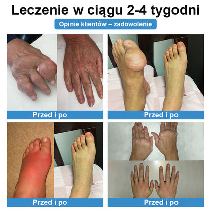 🏅CleraNaure® nanojehličková náplast na klouby