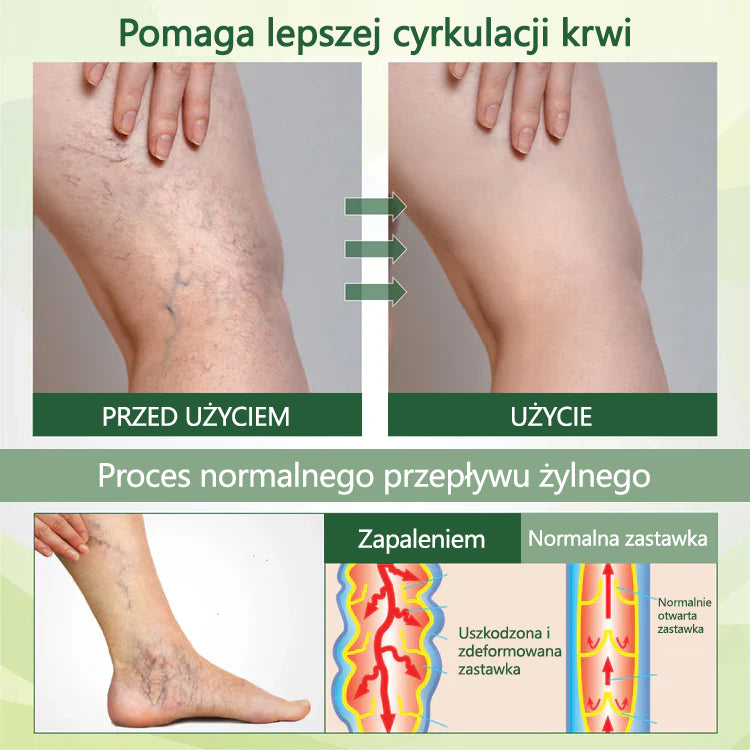 🌿Pożegnaj się z opuchniętymi, bolącymi nogami – CleraNaure® FluidEase Profesjonalny krem na krążenie w nogach przynosi prawdziwą ulgę! ✨🦵