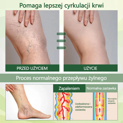 🌿Pożegnaj się z opuchniętymi, bolącymi nogami – CleraNaure® FluidEase Profesjonalny krem na krążenie w nogach przynosi prawdziwą ulgę! ✨🦵
