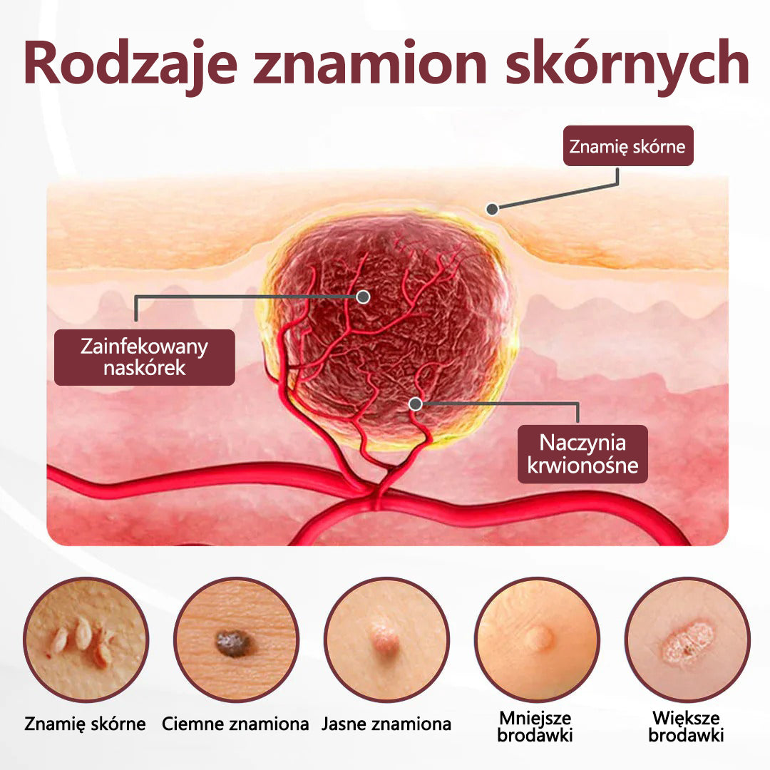 💎 CleraNaure® Keraerase Krem Odnowy o Podwójnym Działaniu - Krem z podwójnym działaniem do regeneracji skóry💎